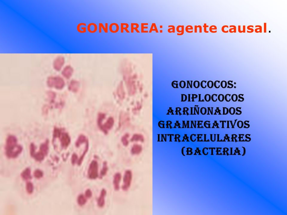 la gonorrea agente causal la gonorrea agente causal